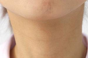 豊島区で家族全員が安心して通える矯正歯科の選び方と治療ガイド