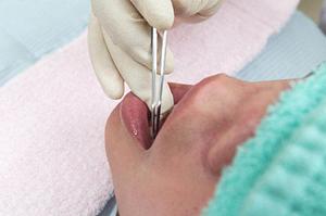 近くで予防歯科診療を受けて歯周病対策