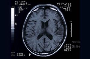 安全対策を徹底している脱毛サロン